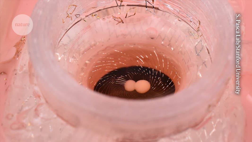 Brain organoids are a transformative technology —...