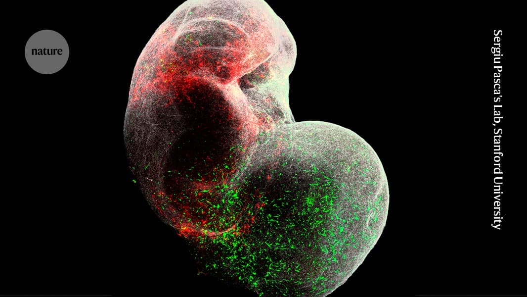 Mini models of the human brain are revealing how...